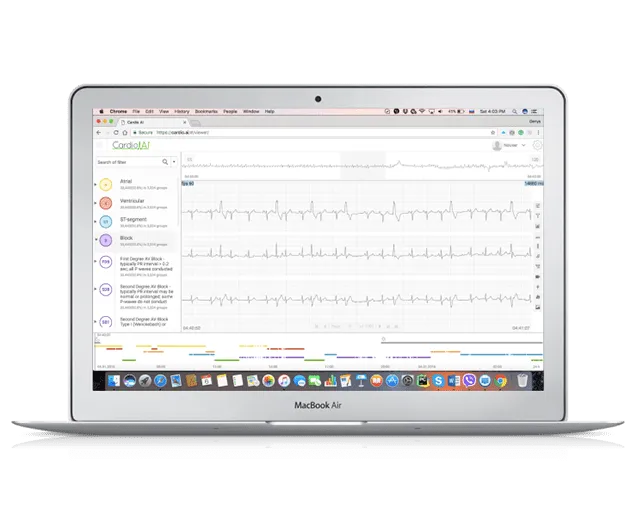 <h2>The Product</h2> <p>is an off-the-shelf software for remote patient monitoring and clinical diagnostics to enable constant cardiac monitoring and patient health surveillance. The tool works with digital health devices and apps to interpret and annotate electrocardiograms.</p> 