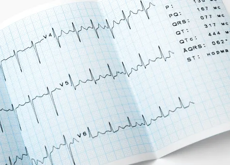 R&#038;D Project: AI-Enabled Interpretation of Electrocardiograms